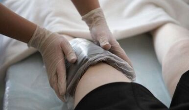 Los métodos de las personas tratan las venas varicosas en las mujeres